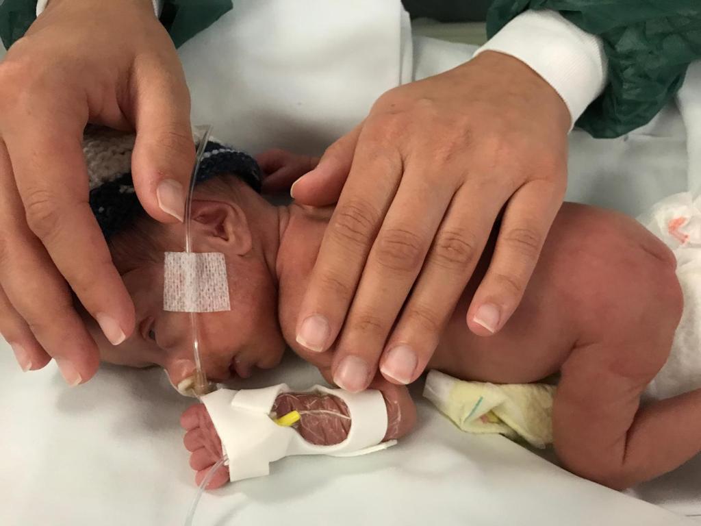 Il “tocco dolce” per i neonati della Terapia Intensiva Neonatale