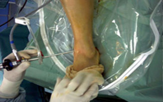 Diagnosi e trattamento di alcune patologie della caviglia