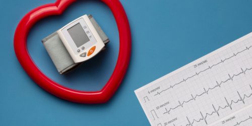 Che cosa sono le aritmie cardiache?